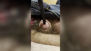 Painful sound removal ends with golden surprise - 10 image