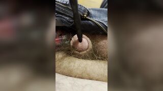 Painful sound removal ends with golden surprise - 11 image