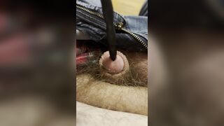 Painful sound removal ends with golden surprise - 13 image
