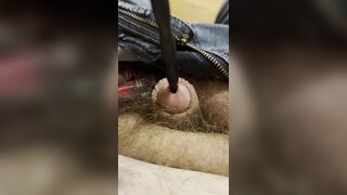 Painful sound removal ends with golden surprise - 14 image