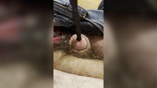 Painful sound removal ends with golden surprise - 15 image