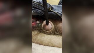 Painful sound removal ends with golden surprise - 9 image