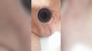 Super Glues Micropenis and Plug into Hole
