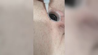 Super Glues Micropenis and Plug into Hole