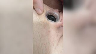 Super Glues Micropenis and Plug into Hole