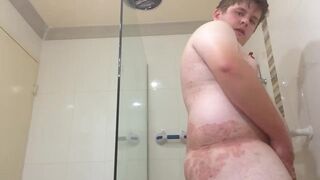 Young Fat Bi Amateur with Small Dick and Skin Condition - 6 image