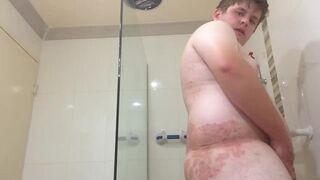 Young Fat Bi Amateur with Small Dick and Skin Condition