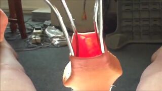 Cock hairy, foreskin sunlight - part 2