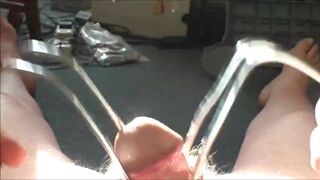 Cock hairy, foreskin sunlight - part 2 - 15 image