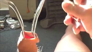 Cock hairy, foreskin sunlight - part 2